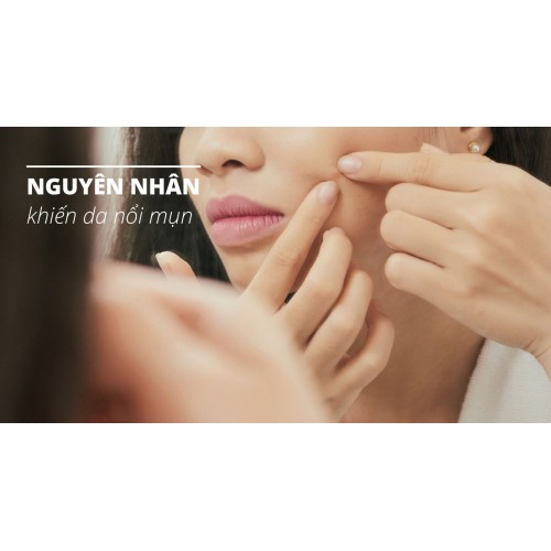 Nguyên nhân nổi mụn và cách trị mụn tại nhà hiệu quả nhất